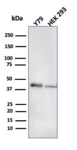 Creatine Kinase BB Antibody (CPTC-CKB-2) - Azide and BSA Free, Novus Biologicals